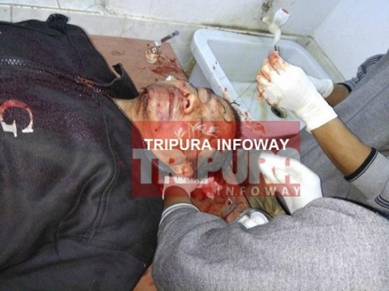 CPI-M's Red Terror begins after Election date's announcement : BJP activist beaten in public rally, left serious at Dharmanagar hospital