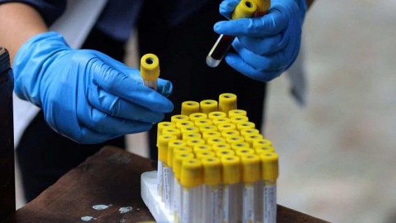 Maha sees slight dip in Covid deaths, toll breaches 69K-mark Maha sees slight dip in Covid deaths, toll breaches 69K-mark