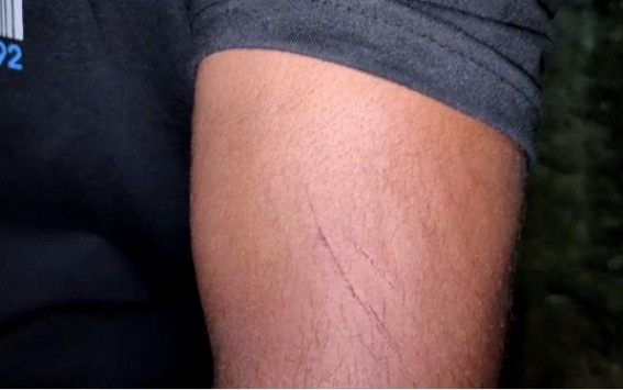 Panchayat member's son beaten up a man centering a petty issue