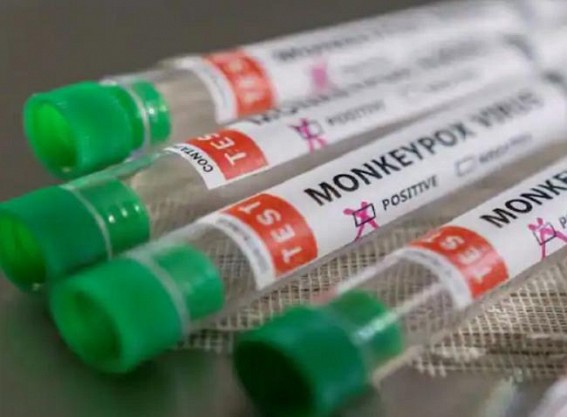 EU buys almost 110,000 doses of Danish vaccine to curb monkeypox