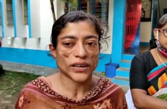 BJP miscreants organised attack on a woman for recording Congress Party Office vandalism in Charipara Sachindralal area : FIR registered against miscreants by Victim