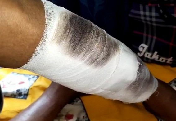Journalist was attacked, injured by Miscreants in Agartala