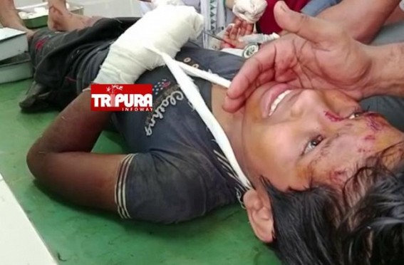 Bomb Blast injured Class-V Student in Boxanagar
