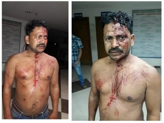 CPI-M supporter beaten, massive violence across Dukli CPI-M supporter beaten, massive violence across Dukli