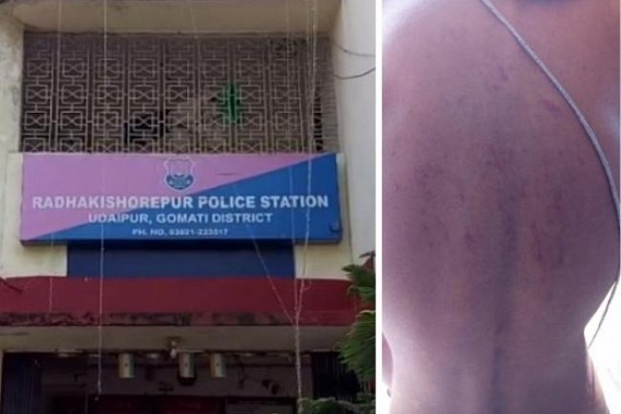 Another ruthless face of Tripura Police exposed : Two youths severely beaten by Gomati Dist Police, Police turned Lawless Another ruthless face of Tripura Police exposed : Two youths severely beaten by Gomati Dist Police, Police turned Lawless