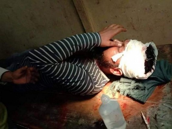 BJP’s political attack injured CPI-M activist, house vandalized BJP’s political attack injured CPI-M activist, house vandalized