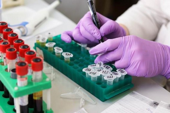 70 more positive cases found in Gujarat; Friday's total 116; 2 deaths 70 more positive cases found in Gujarat; Friday's total 116; 2 deaths