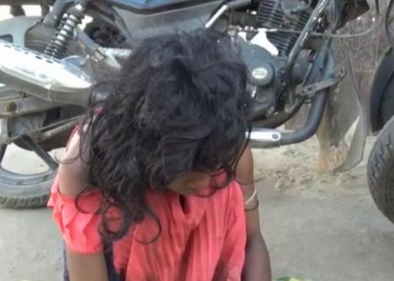 Mentally challenged girl found suffering with rotten hands before GB hospital : Journalists helped her to get Treatment