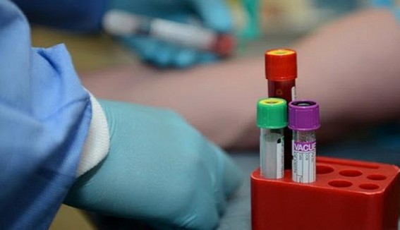 Russia COVID-19 cases up 5,205 to 1,020,310 Russia COVID-19 cases up 5,205 to 1,020,310