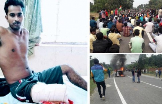 Joint Movement agitator who received bullet injuries lost his leg Joint Movement agitator who received bullet injuries lost his leg