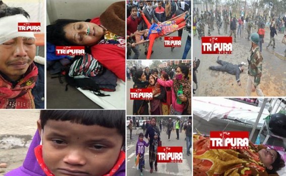 Over 150 Teachers were injured in Barbaric Police Attack under Biplab Deb's Order, 20 severely Injured, 2 Critical : Statewide Public Condemned Attacks on 10323 : Injured Women Teachers Cursed Biplab Deb Over 150 Teachers were injured in Barbaric Police Attack under Biplab Deb's Order, 20 severely Injured, 2 Critical : Statewide Public Condemned Attacks on 10323 : Injured Women Teachers Cursed Biplab Deb