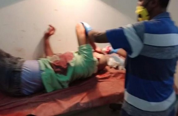 Scooty accident after losing control, severely injured man was hospitalized Scooty accident after losing control, severely injured man was hospitalized