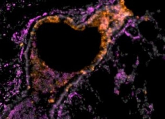 Ultra-low doses of inhaled nanobodies effective against Covid Ultra-low doses of inhaled nanobodies effective against Covid