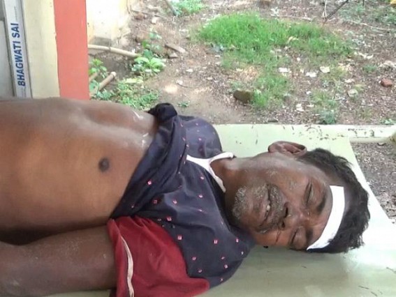 55 Year old man dies due to overdose of alcohol 55 Year old man dies due to overdose of alcohol
