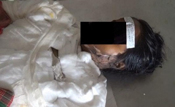 Kailashahar: 2 Men burnt a 15 Yrs old Minor girl to death after pouring kerosene !!!