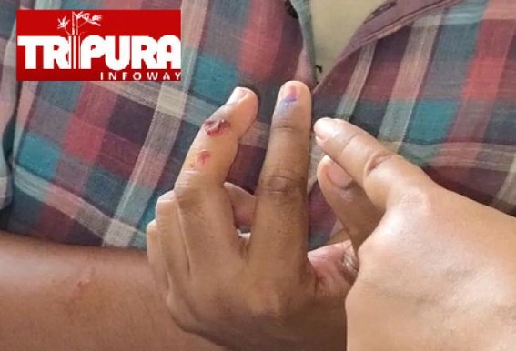 Man Casts Vote in Agartala even after being Attacked by BJP Goons