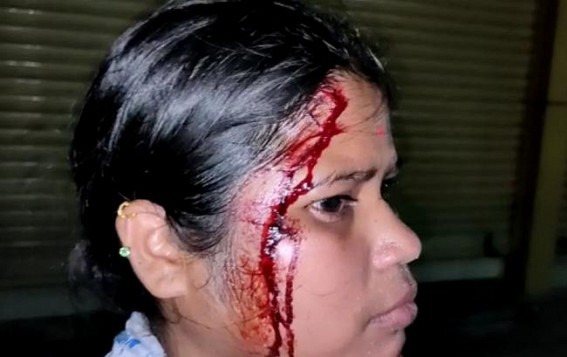 Shame!!! BJP leader mercilessly beaten woman at Nandan Nagar: After 3 times of written complain police did not show up to help her Shame!!! BJP leader mercilessly beaten woman at Nandan Nagar: After 3 times of written complain police did not show up to help her