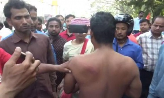 Many Terminated Teachers were injured in Police Brutality in Tripura