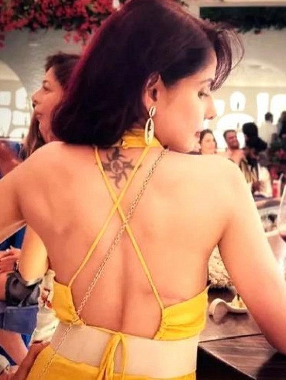 Chhavi Mittal flaunts cancer scar, says she's proud to be cancer survivor Chhavi Mittal flaunts cancer scar, says she's proud to be cancer survivor
