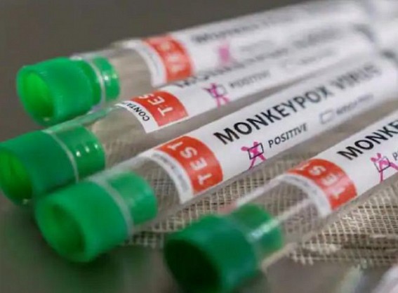 EU buys almost 110,000 doses of Danish vaccine to curb monkeypox EU buys almost 110,000 doses of Danish vaccine to curb monkeypox