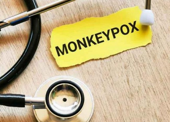 US at risk of losing control of monkeypox outbreak US at risk of losing control of monkeypox outbreak