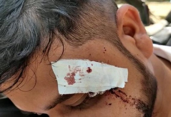 1 injured after miscreants attacked him in Barjala