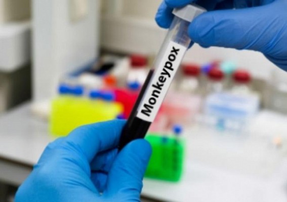 Third monkeypox case registered in Kerala