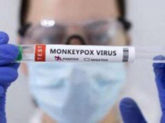 Germany to distribute 19,500 more monkeypox vax doses Germany to distribute 19,500 more monkeypox vax doses