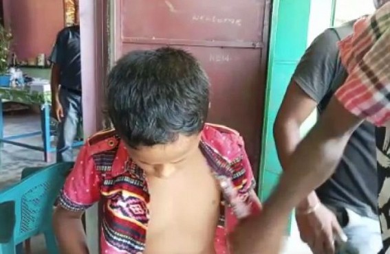Class-V student hospitalized after beaten up by school teacher in a Govt school