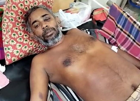 BJP party worker hospitalized, alleged ‘CPI-M beat me up’ BJP party worker hospitalized, alleged ‘CPI-M beat me up’