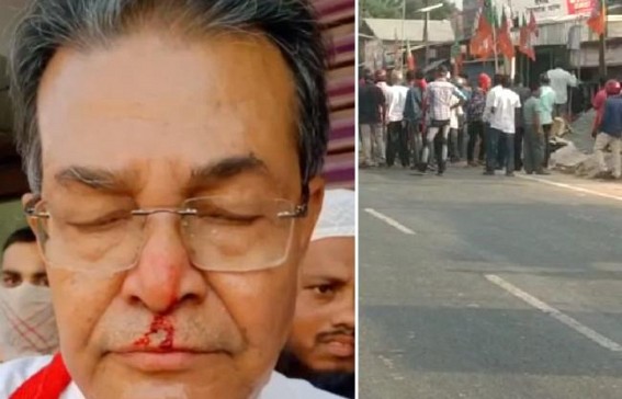 Former CPI-M Minister Bhanulal Saha injured in BJP Goons’ Attack in Charilam