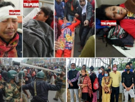 1 Year of Police’s Barbaric Attack on Peaceful Agitators Injuring over 500 Terminated Teachers: 10323 Teachers to Observe ‘Black Day’ on 27th January 1 Year of Police’s Barbaric Attack on Peaceful Agitators Injuring over 500 Terminated Teachers: 10323 Teachers to Observe ‘Black Day’ on 27th January