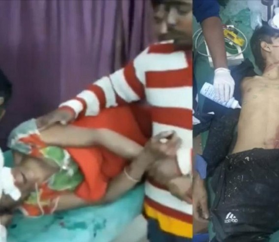 BJP’s Terror under Biplab Deb Continues in Tripura, 2 CPI-M members injured BJP’s Terror under Biplab Deb Continues in Tripura, 2 CPI-M members injured