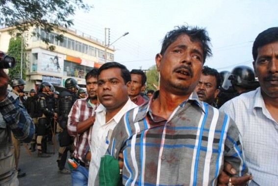 Police lathi charge on congress Civil Disobedience Movement: Manik worried on democratic movement : End of Manik’s rule soon :Ashish Saha; CPI (M) opposed Tripura Bandh Police lathi charge on congress Civil Disobedience Movement: Manik worried on democratic movement : End of Manik’s rule soon :Ashish Saha; CPI (M) opposed Tripura Bandh