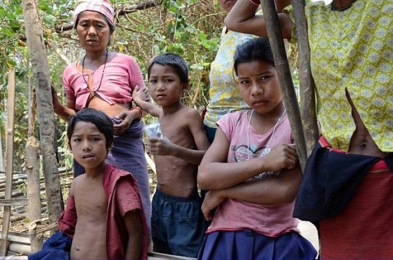 Gandacherra under the grip of chicken pox: Authorities in deep slumber Gandacherra under the grip of chicken pox: Authorities in deep slumber