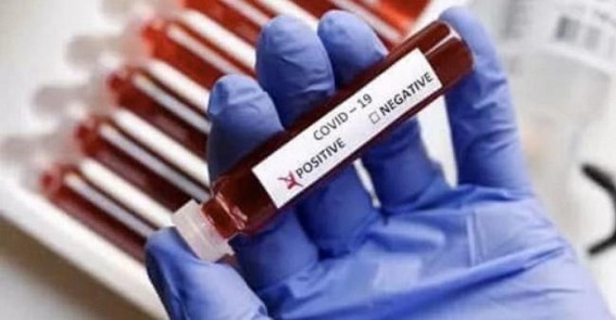 Kerala reports 2 deaths, 193 new Covid-19 cases Kerala reports 2 deaths, 193 new Covid-19 cases