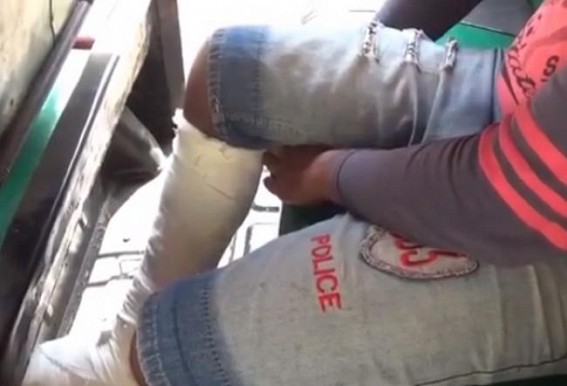 Poor infrastructure : Patient party did not get Wheelchair at GB hospital