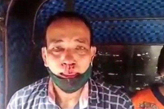 BJP miscreants beaten up student's parent after submitting result review plea in school BJP miscreants beaten up student's parent after submitting result review plea in school