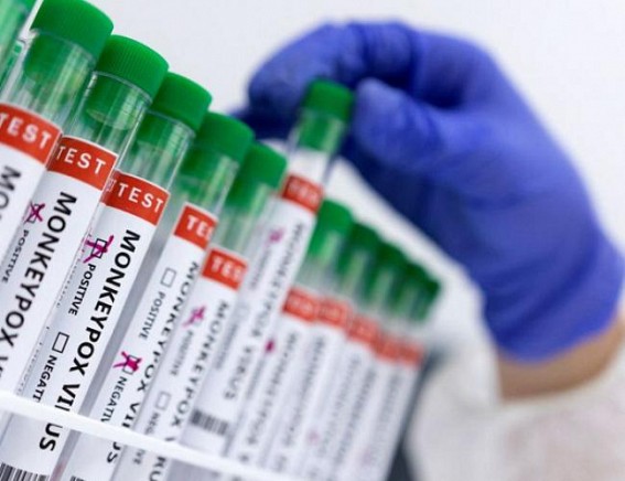 Britain records 104 more monkeypox cases