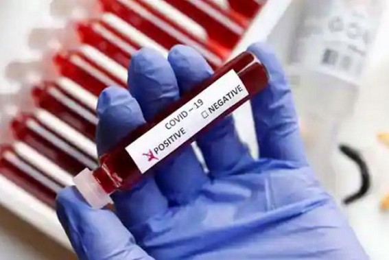 Record single day spike takes AP Covid tally to 23,814 Record single day spike takes AP Covid tally to 23,814