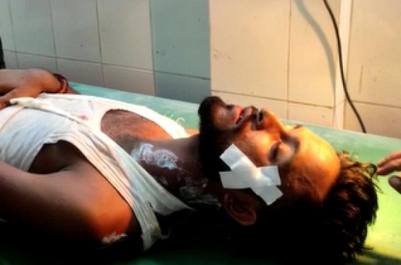 Reckless Driving: Youth Critical after Bike Accident in Madhupur Reckless Driving: Youth Critical after Bike Accident in Madhupur